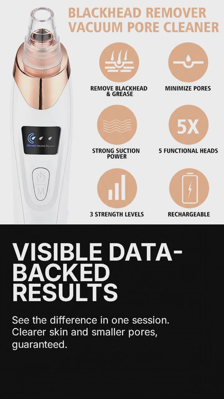 PoreVac Pro™ – Limpiador Facial de Succión Profesional